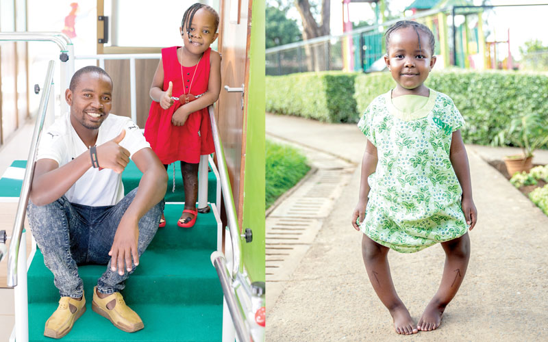 My daughter defied a bowing deformity, narrates Kihara
