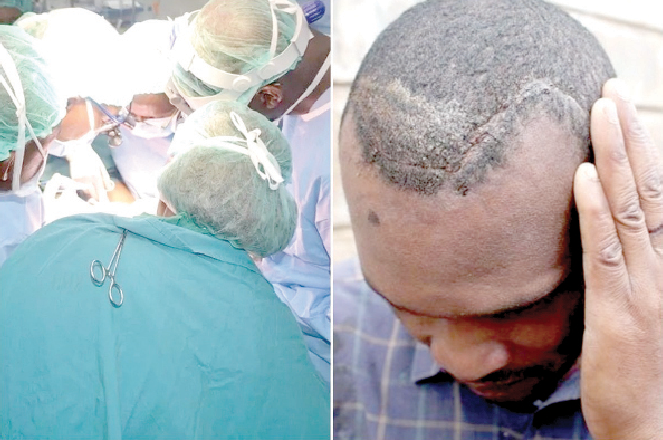 Day KNH doctor performed brain surgery on wrong patient