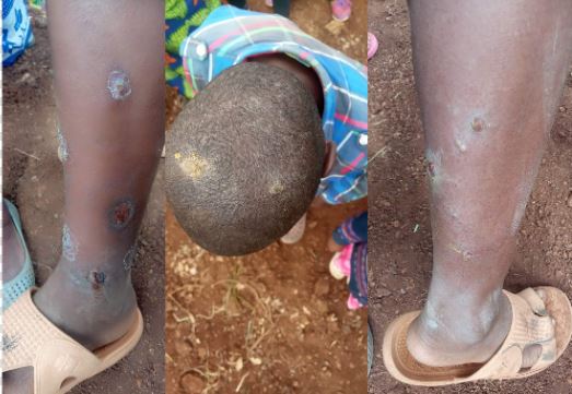 Murang'a: Botfly infestation causes havoc to residents