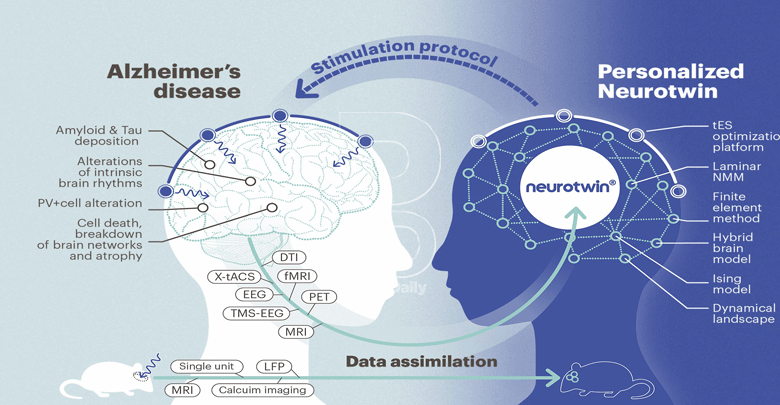 Alzheimer’s disease: The long, gradual goodbye