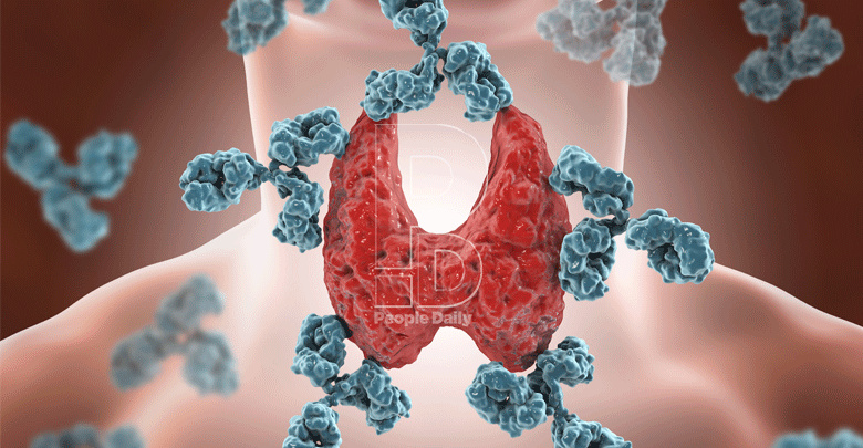 Why your thyroid diagnosis may have been missed