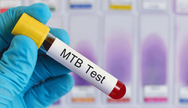 Covid erodes gains in fight against TB