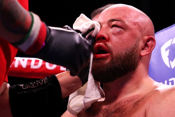 Heavyweight boxer banned from blowing his nose after losing fight