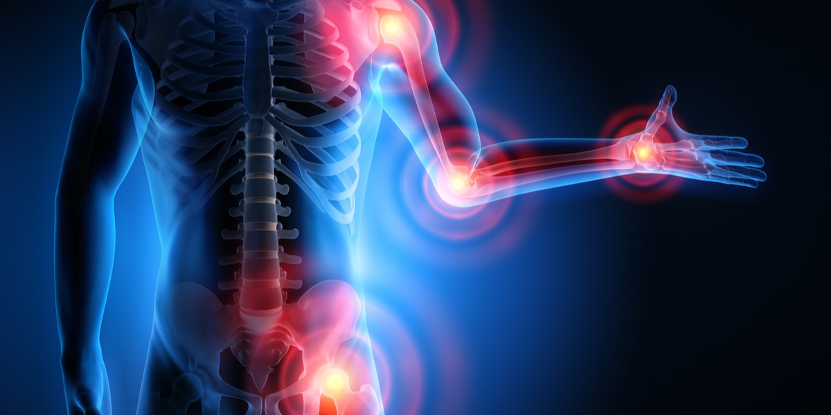 Sedentary lifestyle blamed for increase in cases of arthritis