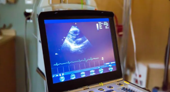 Ultra sound machine goes missing in Voi