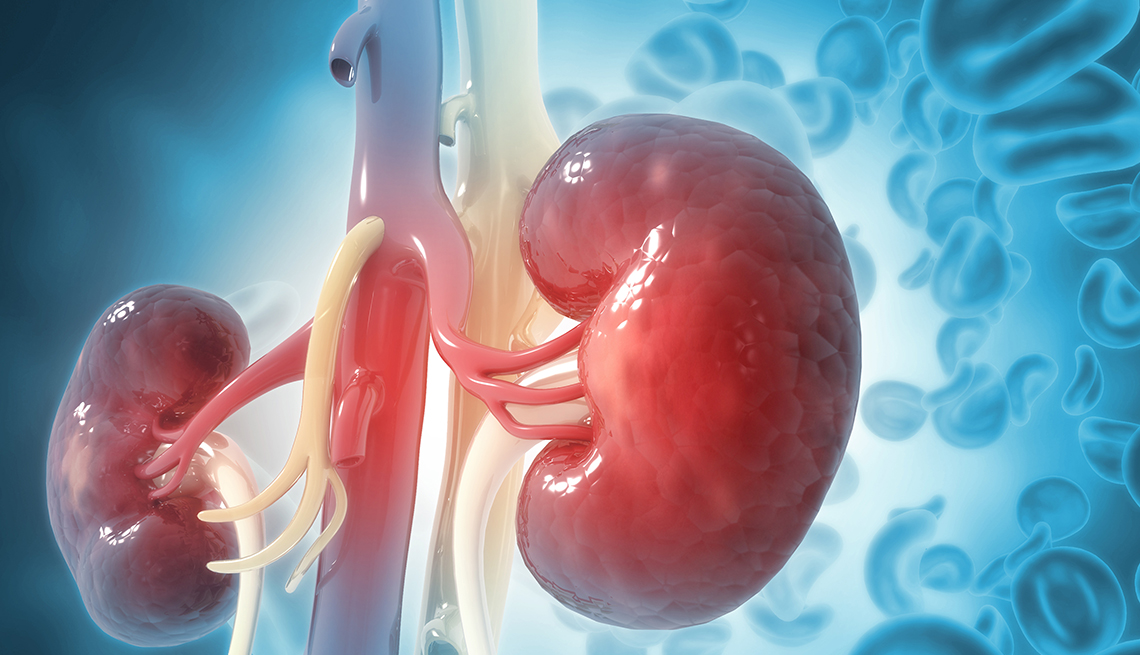 Experts raise alarm over rising rates of kidney disease, blame lifestyle