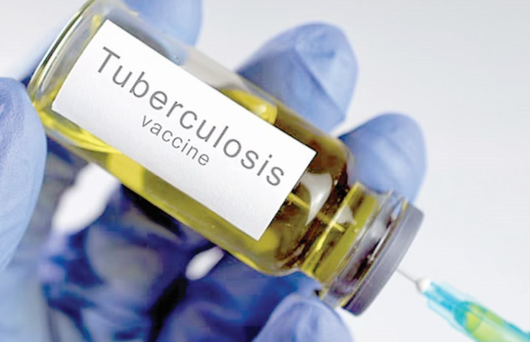 A new study has associated the Bacillus Calmette-Guérin (BCG) tuberculosis (TB) vaccine with reduced likelihood of contracting COVID-19. PHOTO/Print