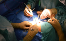 Surgeons performing surgery. Image used for illustration purposes only. PHOTO/Pexels