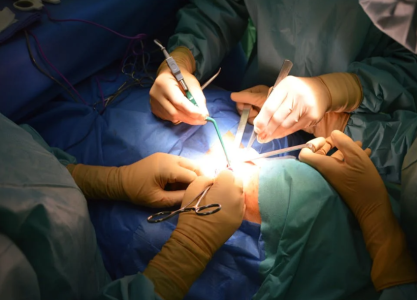 Surgeons performing surgery. Image used for illustration purposes only. PHOTO/Pexels