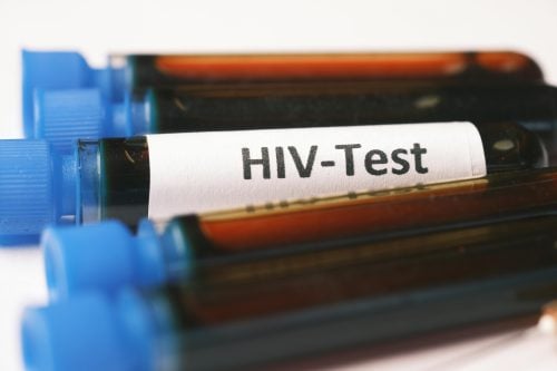 An HIV test. Image used for representation purposes. PHOTO/Pexels