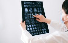 What being declared ‘brain dead’ means
