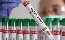 First Mpox case in Embu tests county's disease surveillance network
