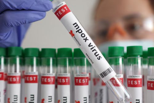A test tube labelled Mpox. PHOTO/@SABCNews/X