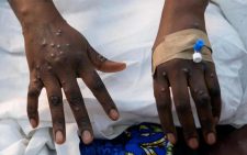 Kenya issues Marburg Virus warning following Ethiopia outbreak